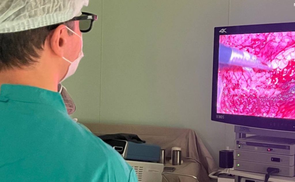 Хирурги ГКБ имени Валентина Буянова удалили более 100 камней из почек пациентки. Фото: Telegram-канал ГКБ имени Валентина Буянова