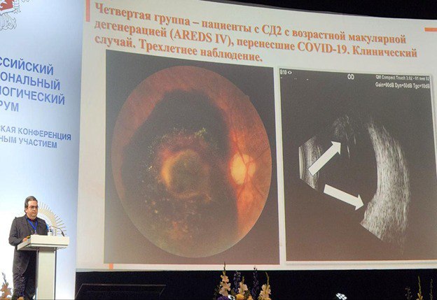 Сотрудники ГКБ имени Валентина Буянова представили доклад на XVIII Российском общенациональном офтальмологическом форуме. Фото: Telegram-канал Городской клинической больницы имени Валентина Буянова